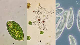 Microorganism moving methods  Flagella Pseudopodia and Cilia [upl. by Harutek]