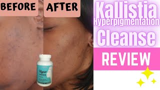 Kallistia Hyperpigmentation Cleanse Supplements REVIEW skincare [upl. by Merle153]