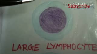 Small Lymphocytes and Large Lymphocytes [upl. by Suiluj]