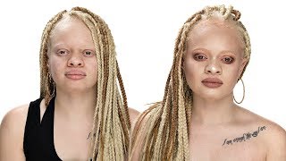 MAKEUP TUTORIAL FOR WOMEN WITH ALBINISM ft fenty beauty profilter foundation [upl. by Noeled270]