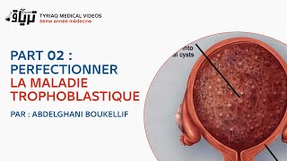 PART 02 PERFECTIONNER LA MALADIE TROPHOBLASTIQUE  mole hydatiforme   PAR  ABDELGHANI BOUKELLIF [upl. by Irdua12]