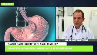 Gastrit  Op Dr Umut Serhat EKTİRİCİ [upl. by Chabot631]