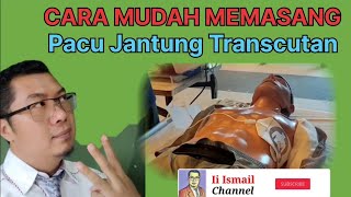 Prosedur Pemasangan Pacu Jantung Trancutan atau Eksternal Pacing by II ISMAIL [upl. by Ishii177]