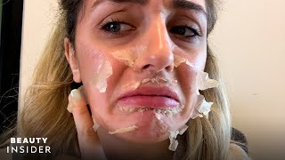 What It’s Like To Get A Chemical Peel For Acne Scars  Beauty Explorers  Beauty Insider [upl. by Aleka]