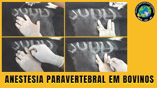 🐮 Como fazer ANESTESIA PARAVERTEBRAL EM VACAS [upl. by Konopka242]