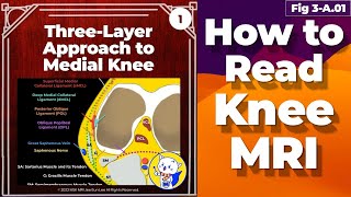 Fig 3A01 ThreeLayer Approach to Medial Knee [upl. by Strawn102]