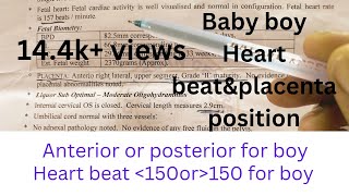 My baby reports placenta position and heart beat of gender based on placenta positionbaby reports [upl. by Ruprecht295]