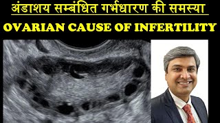 अंडाशय सम्बंधित गर्भधारण की समस्या  OVARIAN CAUSE OF INFERTILITY [upl. by Eeralih]