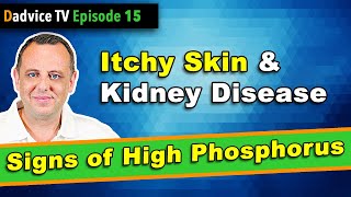 Itchy Skin amp Chronic Kidney Disease  A sign of low kidney function amp high phosphorus [upl. by Aelak]