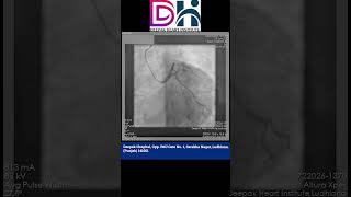 Coronary Angiography CAG Procedure  Deepak Heart institute [upl. by Lotti377]