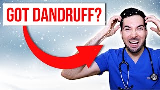 How to get rid of dandruff permanently at home and treatment [upl. by Colon]