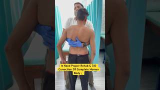 Severe scoliosis chiropractic treatment Say big no ☠️☠️ by DrRavi scoliosis chiropractic spine [upl. by Lipkin]