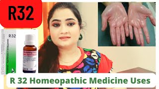 R 32 Homeopathic Medicine Uses In Hindi By Anusuya Chakrabarti [upl. by Pattie]