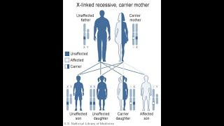 Sex linked inheritance Part 2 X linked recessive traits [upl. by Las]