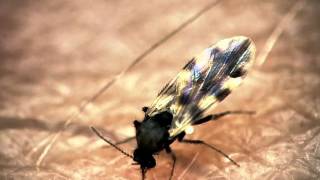 Midge bites through presenters arm  The Secret Life of Midges  BBC One [upl. by Myrah]