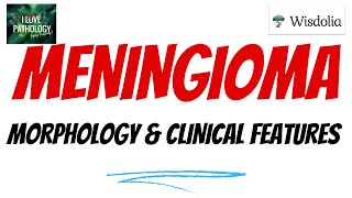 MENINGIOMA  Part 2  Histopathology  Clinical features Treatmentamp prognosis [upl. by Roth]