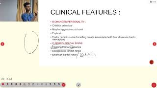 Hepatic encephalopathy [upl. by Fleisig]