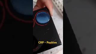 CRP test procedure  CRP blood test  medicalstudent youtube shorts [upl. by Halima]