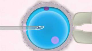 Icsi IVF  Intracytoplasmic Sperm Injection [upl. by Noguchi]