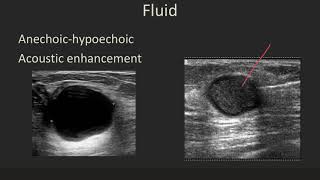 Ultrasound 101 Part 5 Terminology and Tissuesmp4 [upl. by Ignazio542]