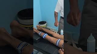 Tens therapy sciatica muscle pain [upl. by Saunderson615]