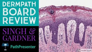 Dermpath Board Review 100 Classic Cases [upl. by Novanod]