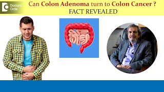 Can Colon Adenoma turn to Colon Cancer  Colon Polyp Removal Dr Rajasekhar M R  Doctors Circle [upl. by Wadell]