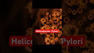 Do You Have Helicobacter Pylori  Symptoms Of Hpylori gastritis helicobacterpylori shorts [upl. by Llenehs]