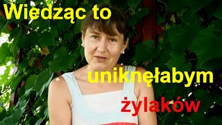 Żylaki Jak Zapobiegać  Żylaki Kończyn Dolnych [upl. by Ahsaela]