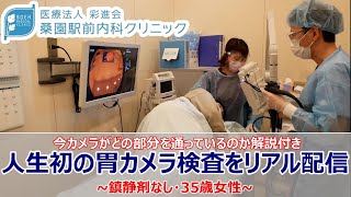 【胃カメラ内視鏡検査】人生初の胃カメラ検査をリアル配信 ～鎮静剤なし・35歳女性～ 今カメラがどの部分を通っているのか解説付き【桑園駅前内科クリニック】 [upl. by Horn]