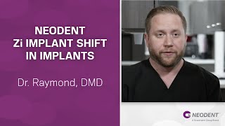 Neodent Zi Implant Shift in Implants  Dr Raymond [upl. by Doerrer616]