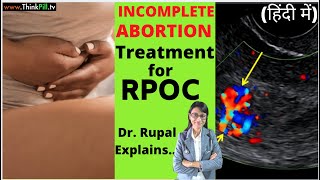 Incomplete Abortion😞 Dr Plz  Give Treatment for RPOC Hindi LadiesHealth [upl. by Gnahk]