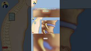 Triactin 4 Tablet Uses  Thiocolchicoside aceclofenac and paracetamol tablet uses [upl. by Bat284]