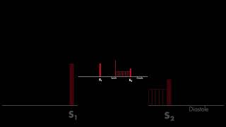 Mitral Valve Prolapse Heart Sound heart cardiology heartsounds [upl. by Zucker]