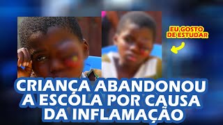 Adolescente de 14 anos sofre com inflamação no olho esquerdo “ TV ZIMBO “ Fala Angola [upl. by Hayley]