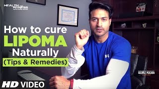 What Is Lipoma लाइपोमा  How to cure LIPOMA Naturally  Tips by Guru Mann [upl. by Kondon]