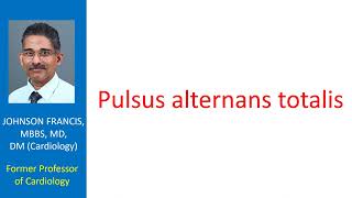 Pulsus alternans totalis [upl. by Nigle]