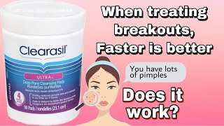 CLEARASIL Deep Pore Cleansing Pads Does it work [upl. by Aimil]