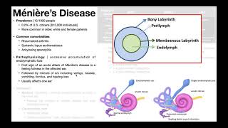 👂 Ménière’s Disease  Presentation Pathophysiology Diagnosis amp Treatment [upl. by Adnohsal311]