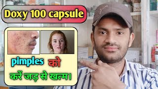 Doxy 100 capsule use dose benefits and side effects full review in hindi [upl. by Suaeddaht]