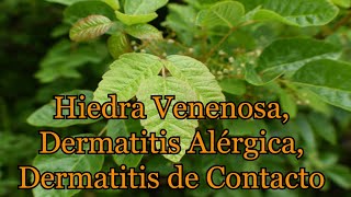 Hiedra venenosa Dermatitis Alérgica Dermatitis de Contacto [upl. by Adnoraj]