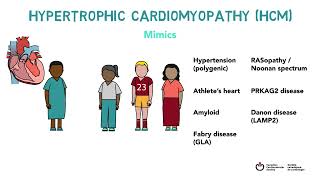 Hypertrophic Cardiomyopathy HCM Clinical Practice Update Whiteboard Video [upl. by Just]