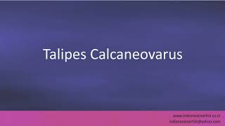 Pronunciation of the words quotTalipes Calcaneovarusquot [upl. by Nowell]