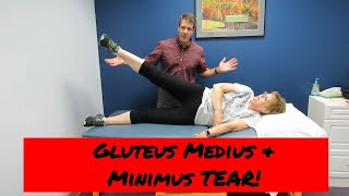 Gluteus Medius and Minimus tear vs Greater Trochateric Bursitis [upl. by Enom]