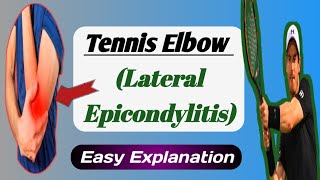 Tennis Elbow Explained Lateral Epicondylitis [upl. by Korie]