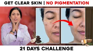 How to Treat Melasma at Home  21 Days skin care Challenge for Radiant Skin  Skin Care [upl. by Ellingston490]