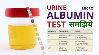 Micro Albumin Urine Test Procedure Results Analysis and Normal Range in Hindi [upl. by Nnaytsirk457]