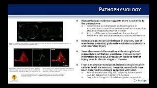 Indications Cervical Spondylotic Myelopathy  Benjamin Kafka MD [upl. by Yelad290]