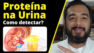 O que causa proteinúria Qual exame detecta perda de proteína na urina Microalbuminúria  Albumina [upl. by Keslie]