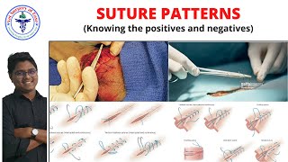 Suture Patterns  General Surgery  Lecture 08 [upl. by Aramak]